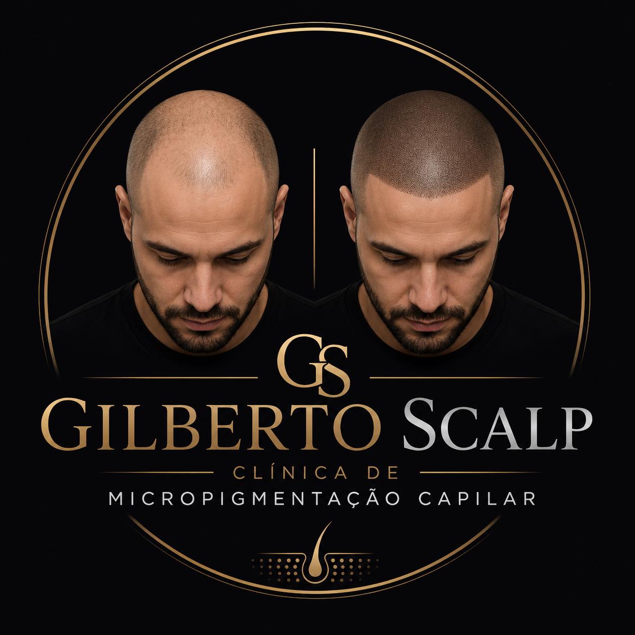 Gilberto ππππ₯π© Facebook ad: Profissional 100% qualificado na area da micropigmentacaoβ¦
