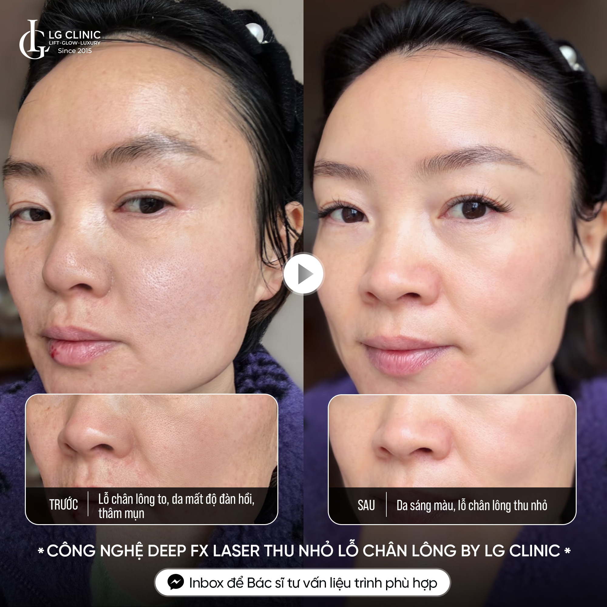 Viện Thẩm Mỹ LG Clinic Facebook ad