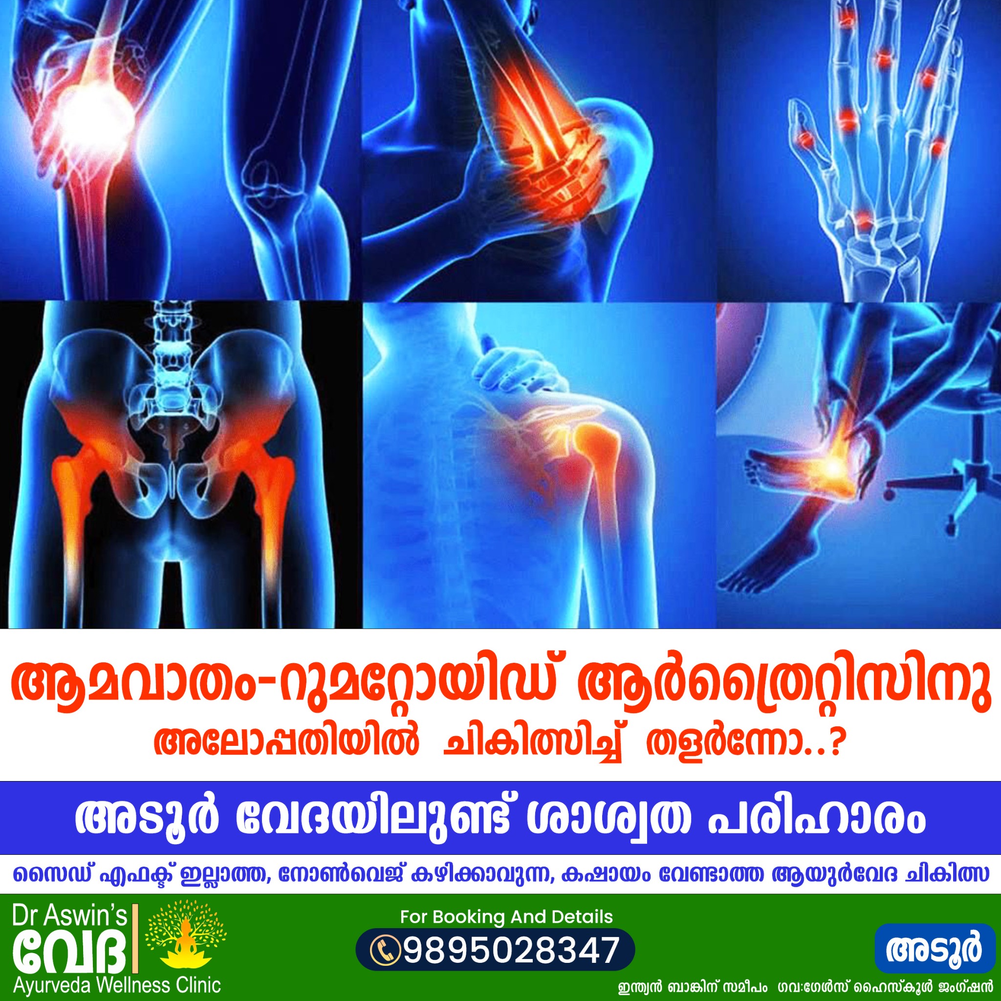 Veda Ayurveda Hospital Adoor Facebook ad: For Booking and Details
