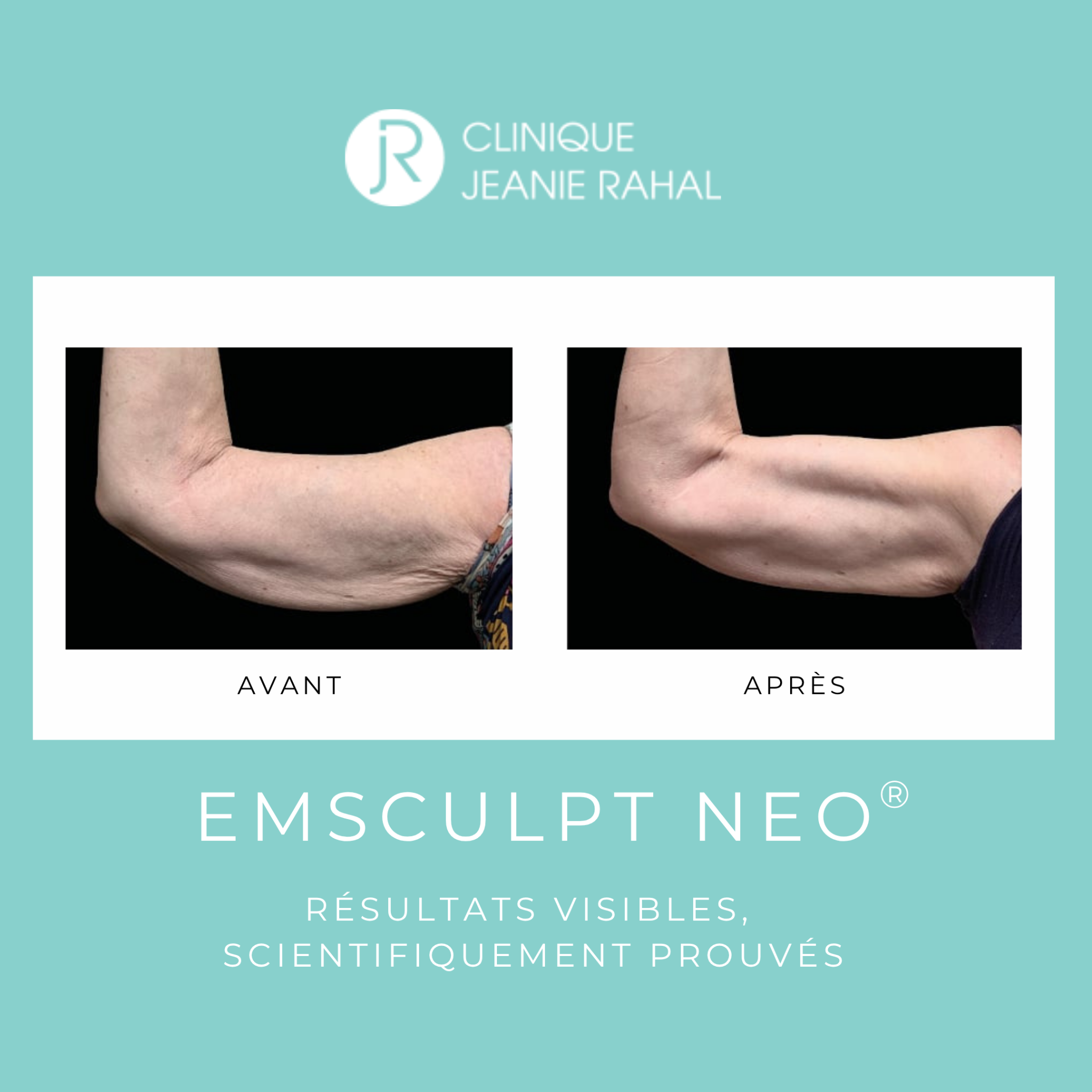 Clinique Jeanie Rahal Facebook ad