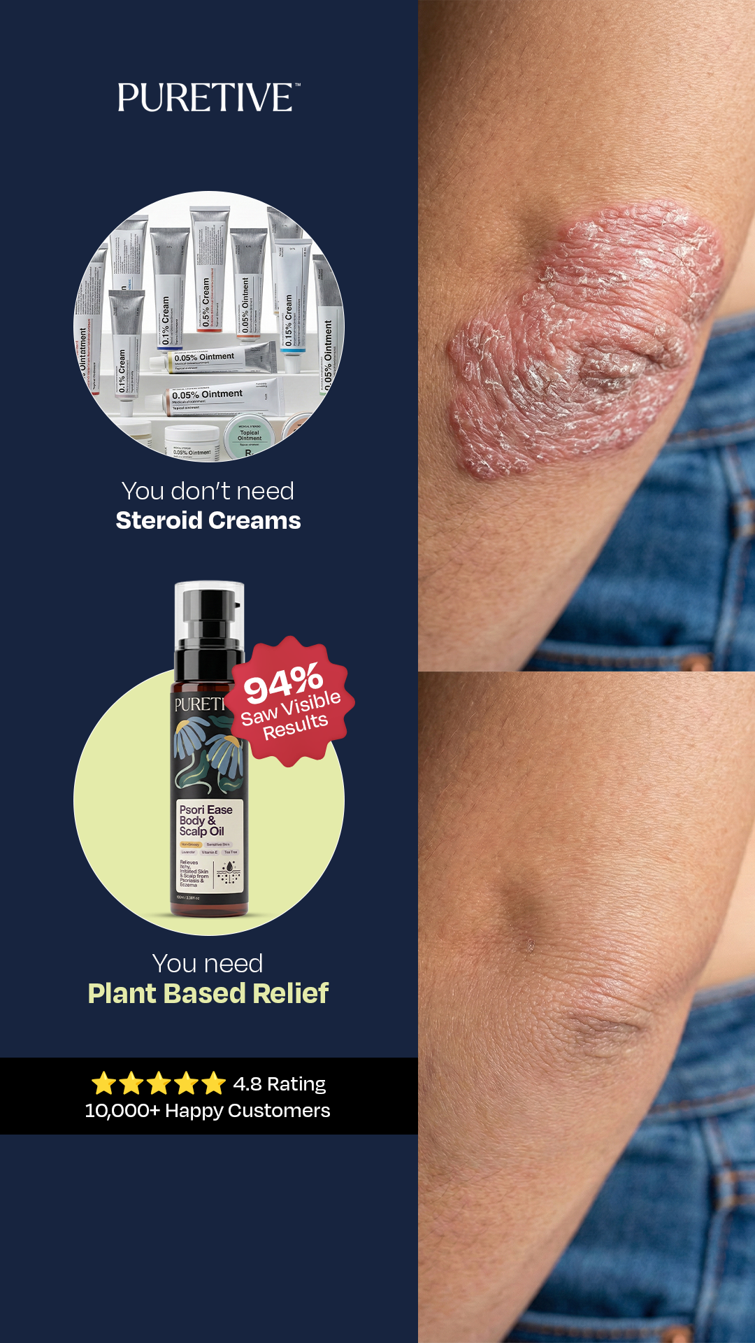 Puretive.co Facebook ad: Calm Itchy, Flaky Skin Naturally