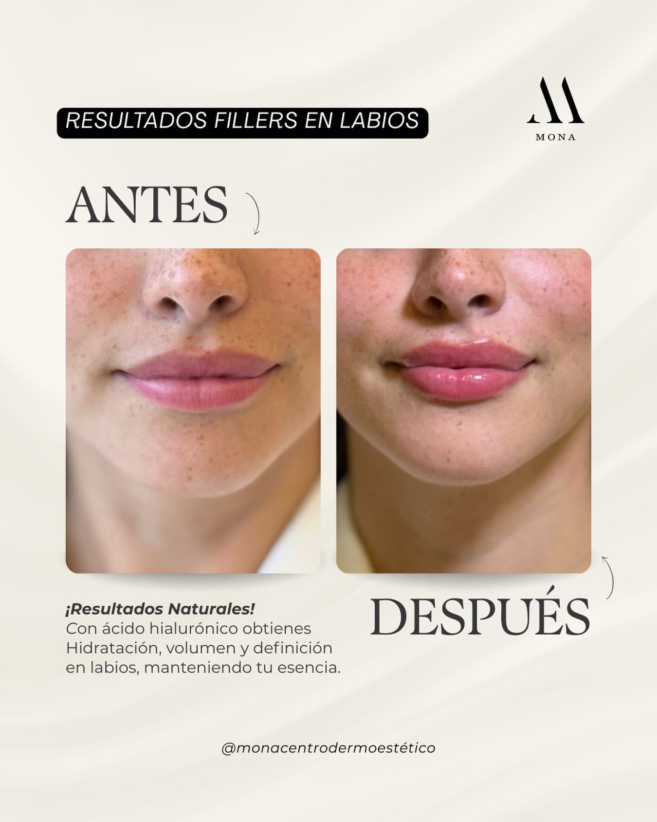 Mona Centro Estetico  Facebook ad