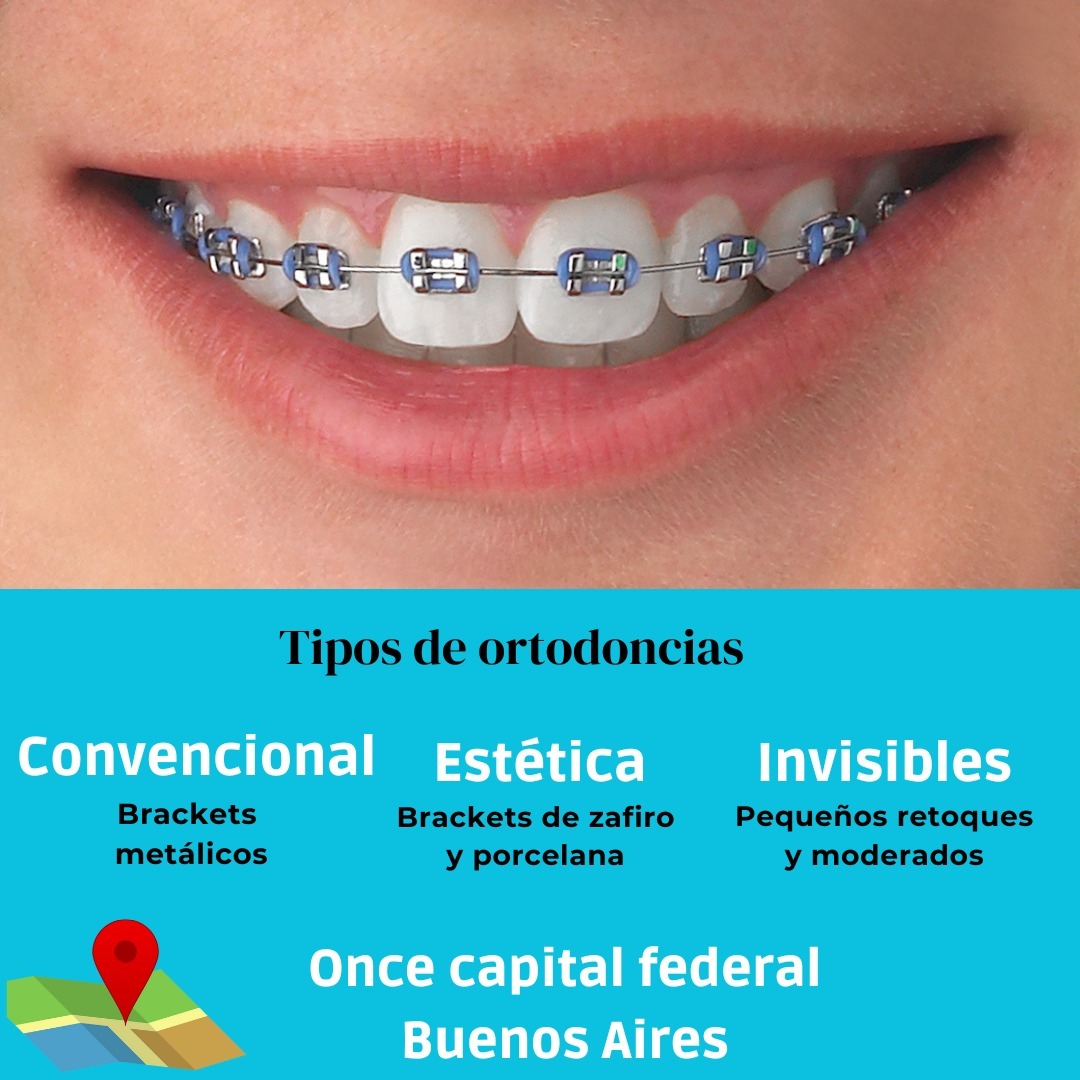 Odontología Delatorre Facebook ad