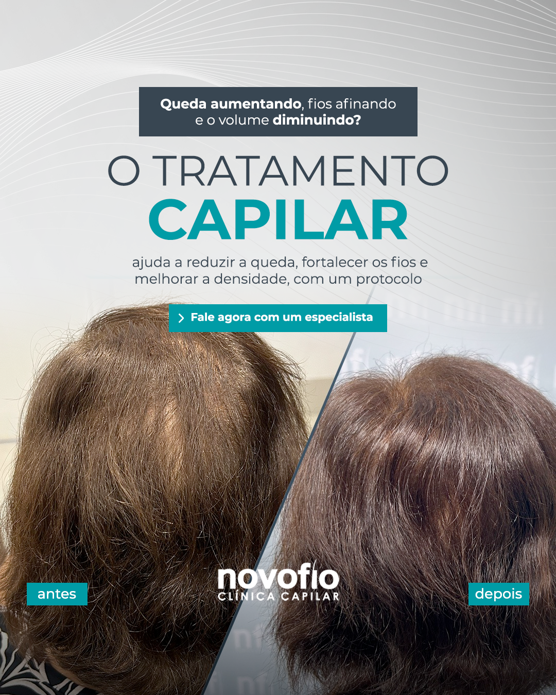 Novofio Bauru Clínica Capilar Facebook ad
