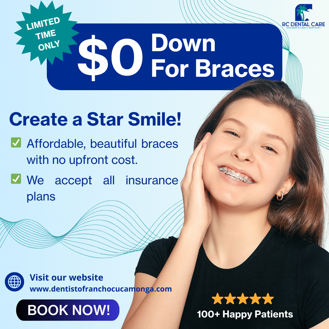 Rancho Cucamonga Dental Care Facebook ad: Get Braces with $0 Down