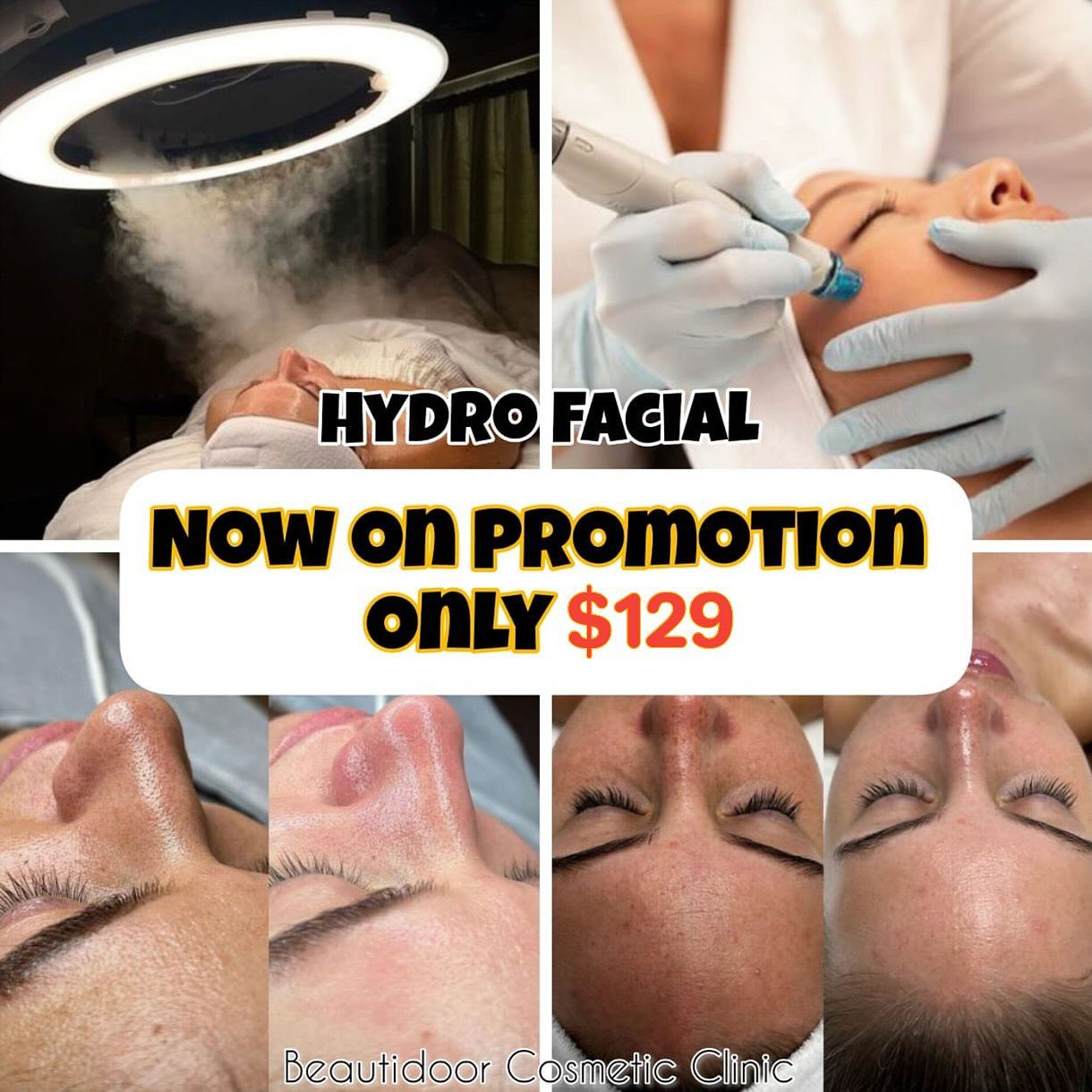 BeautiDoor Facebook ad: HydroFacial, Deep Clean, Deep Glow