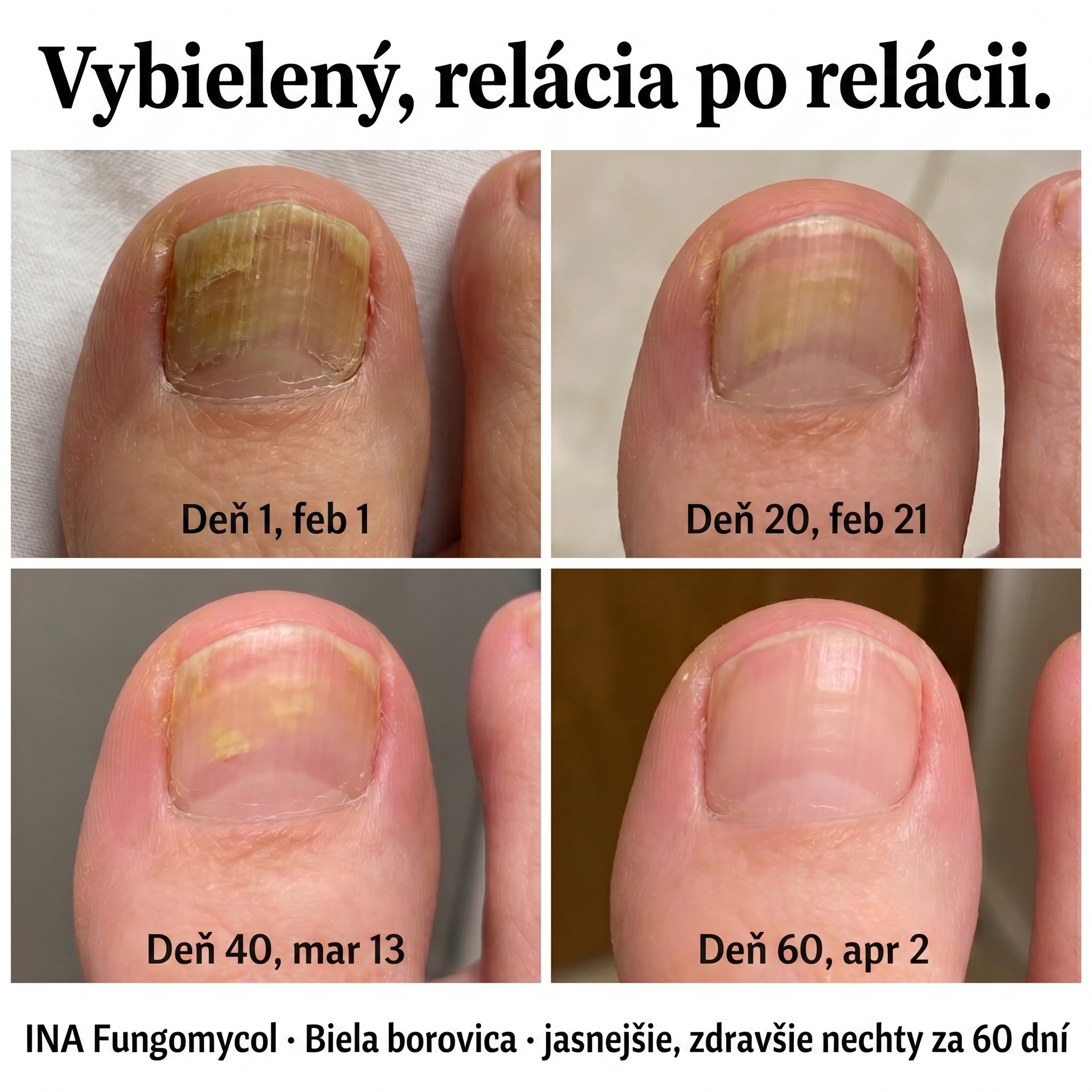 Rodinná Organická Kozmetika - InaEssentials.SK Facebook ad: Sleduj, ako žltá farba bledne, týždeň po týždni