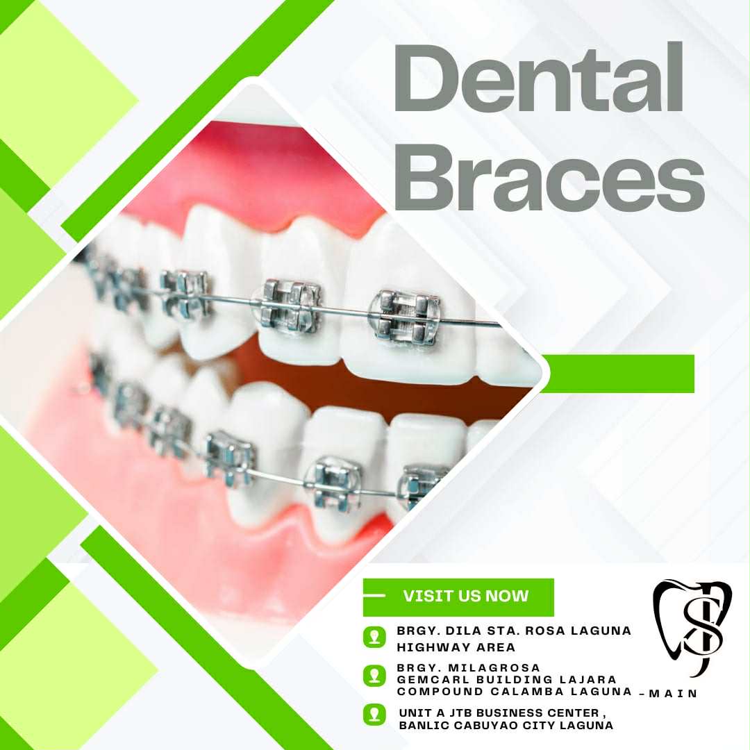 SJ Dental Clinic Sta Rosa Facebook ad: Good Day, Dearest Clients & Patients!