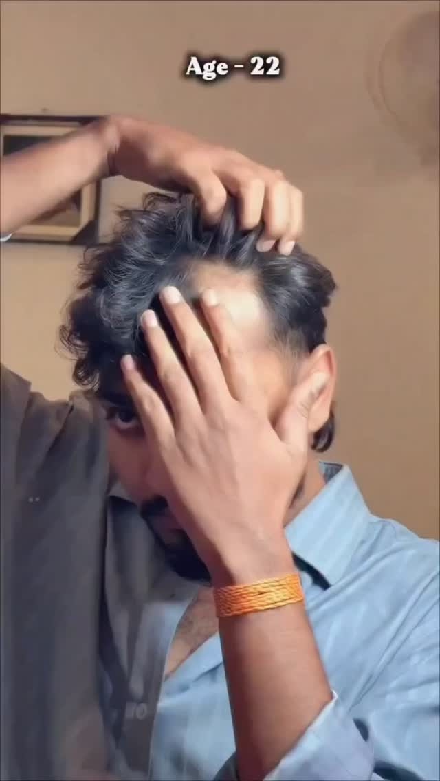 Yalla Hair - Hair Patch Fixing & Hair Replacement Centre Facebook ad: Noticing hair thinning earlier than expected can be…