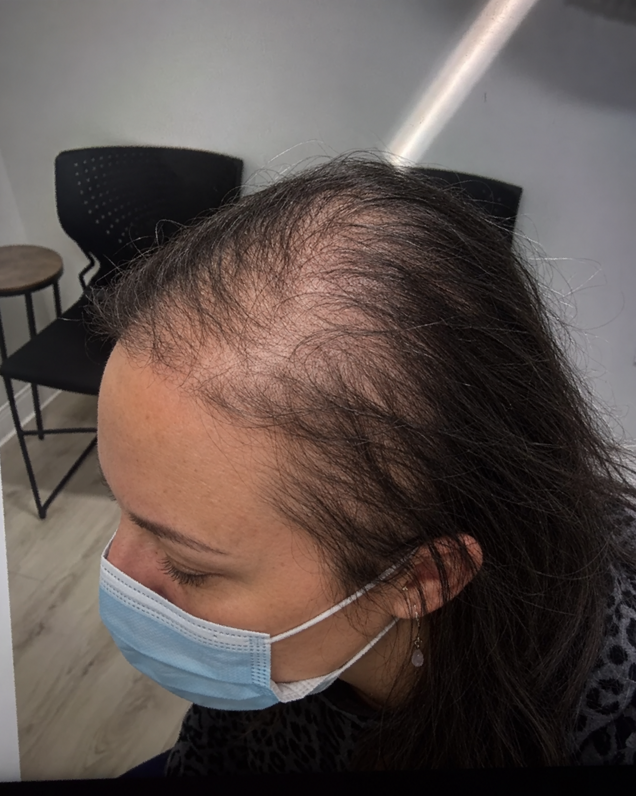 Dr. Patricia Sullivan Facebook ad: The reason why my patient was losing her hair