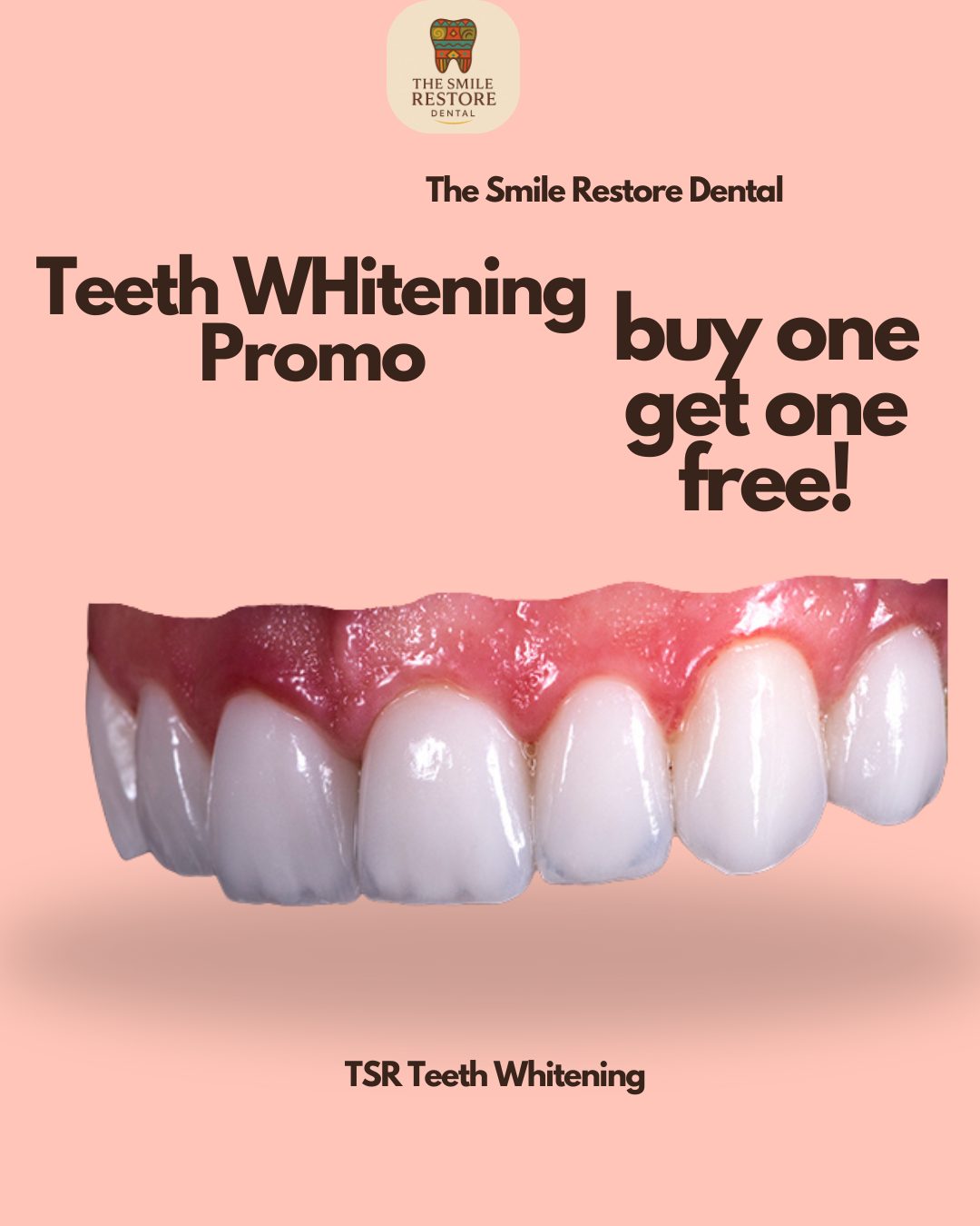 Smile Restore Dental Facebook ad: TSR Pricelist