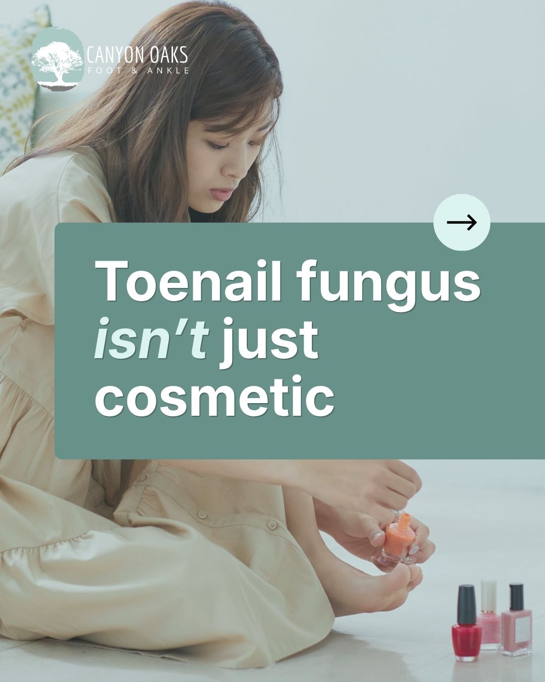 Canyon Oaks Foot Ankle Facebook ad: Toenail fungus affects 1 in 10 adults in…