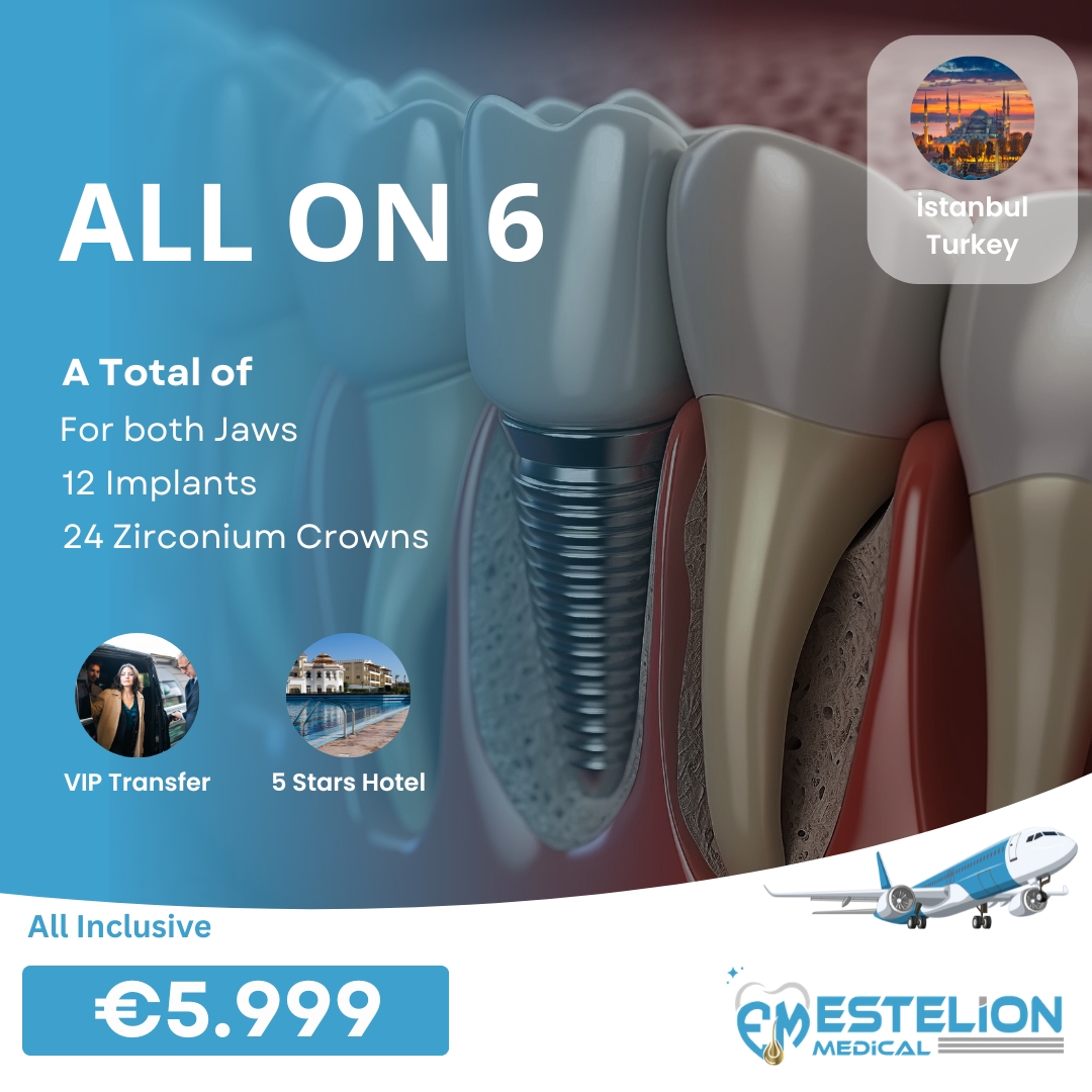 Estelion Dental Facebook ad: Istanbul / Turcia