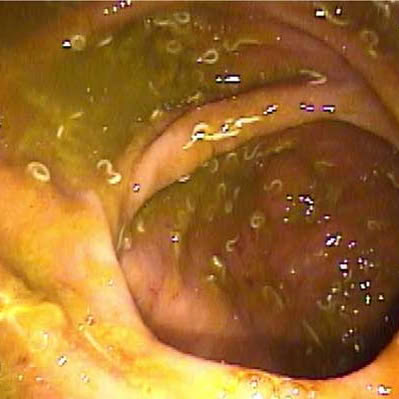 Dr. Angelina Young Facebook ad