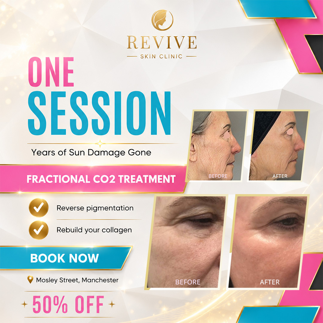 Revive - Skin Clinic Facebook ad: 50% Off CO2 Laser at Revive! Bye wrinkles & scars!