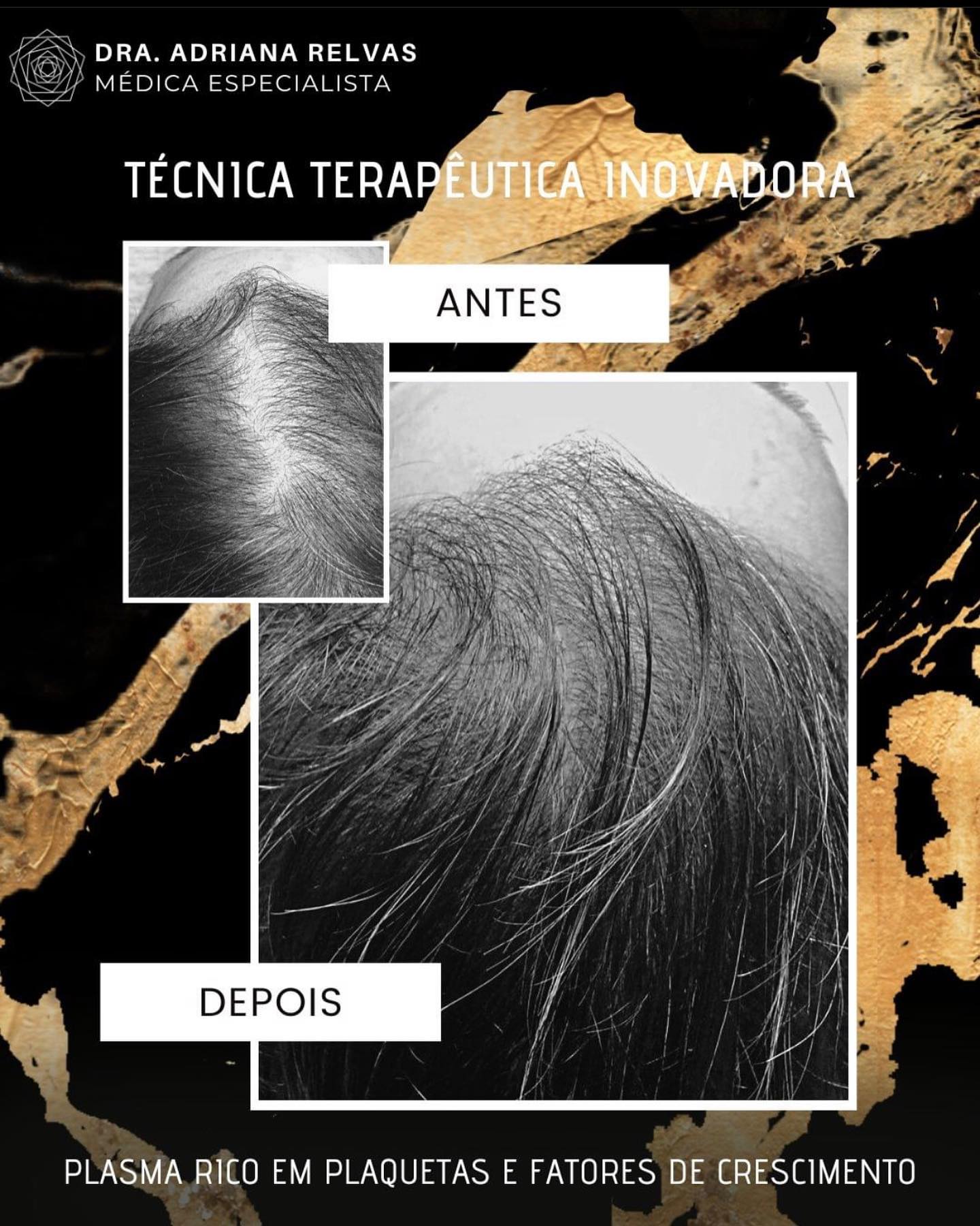 Drª Adriana Relvas Facebook ad: Unidade de Medicina Estética | Fortius Clinic