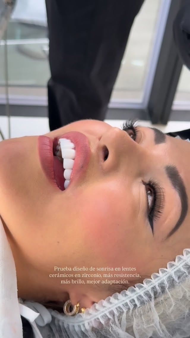 American Dental Smile Facebook ad: Diseño de sonrisa en lentes cerámicos en zirconio.
