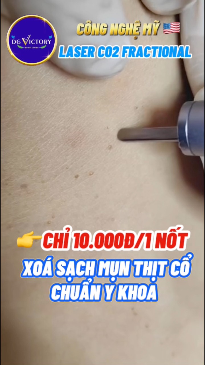 DG Victory Beauty Center Facebook ad: ๐๐ฬฬฃ๐ ๐๐๐๐๐ ๐๐๐๐ ๐๐ฬฬ๐ - ๐๐๐ฬ ๐๐ฬโฆ