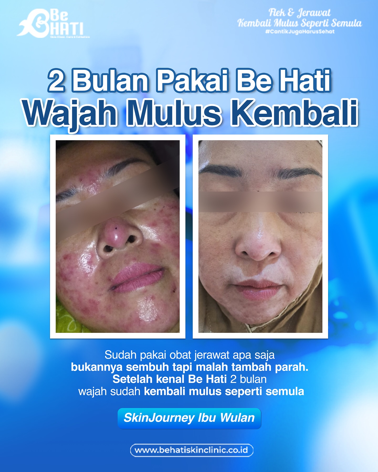 Be Hati Skin Clinic Facebook ad