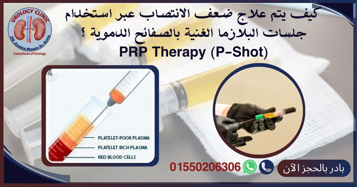 عيادات د/ أحمد مندي الأغا - استشاري جراحة المسالك البولية و التناسلية Facebook ad: تعتبر جلسات البلازما (PRP - P Shot )…