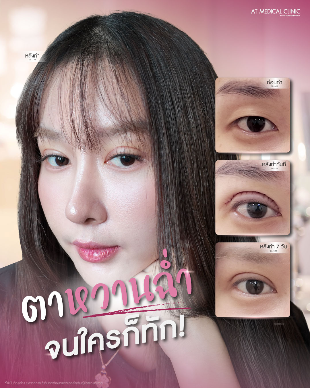 At Medical Clinic สาขา พัทยา Facebook ad