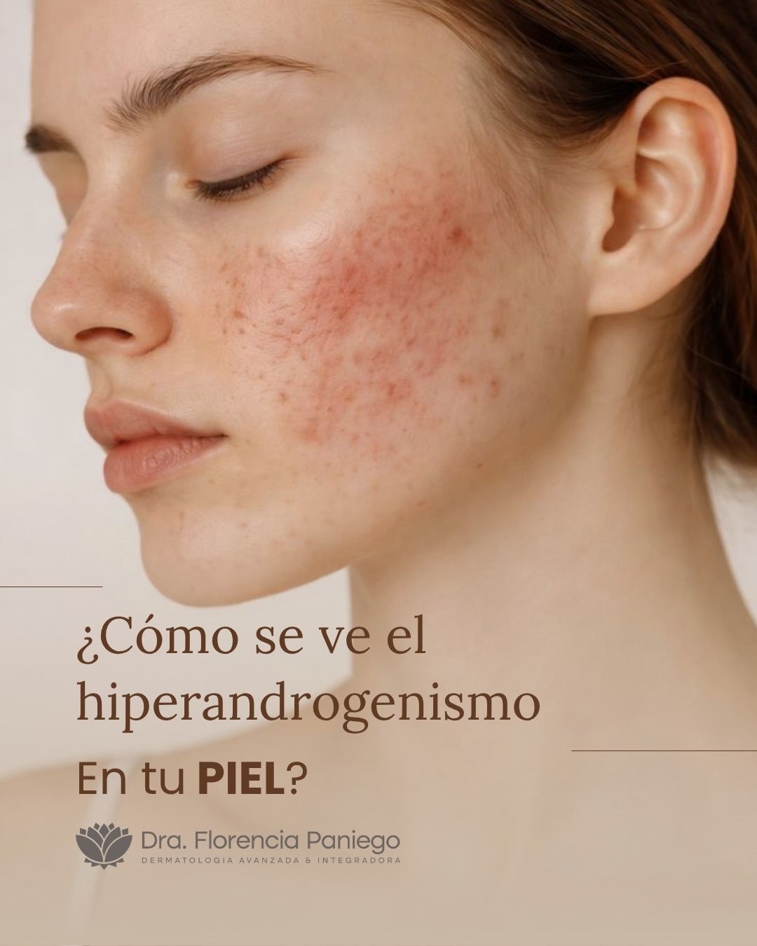 Florencia Paniego Dermatóloga Facebook ad