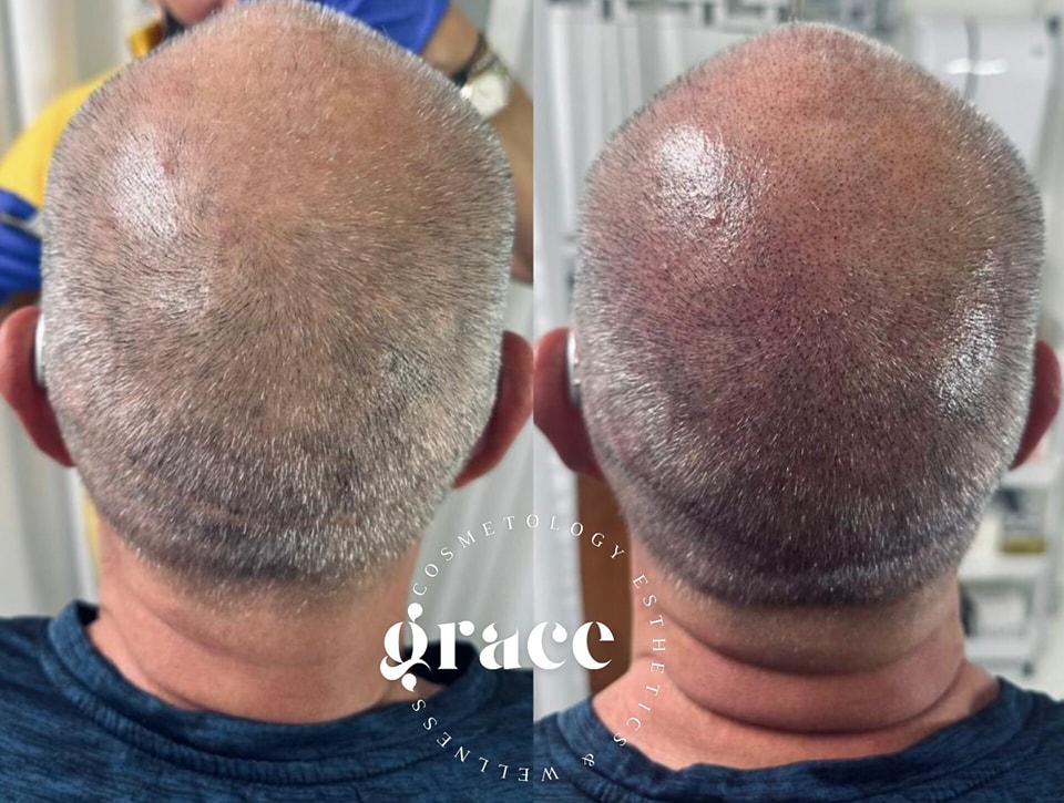 Grace Cosmetology Esthetics Facebook ad