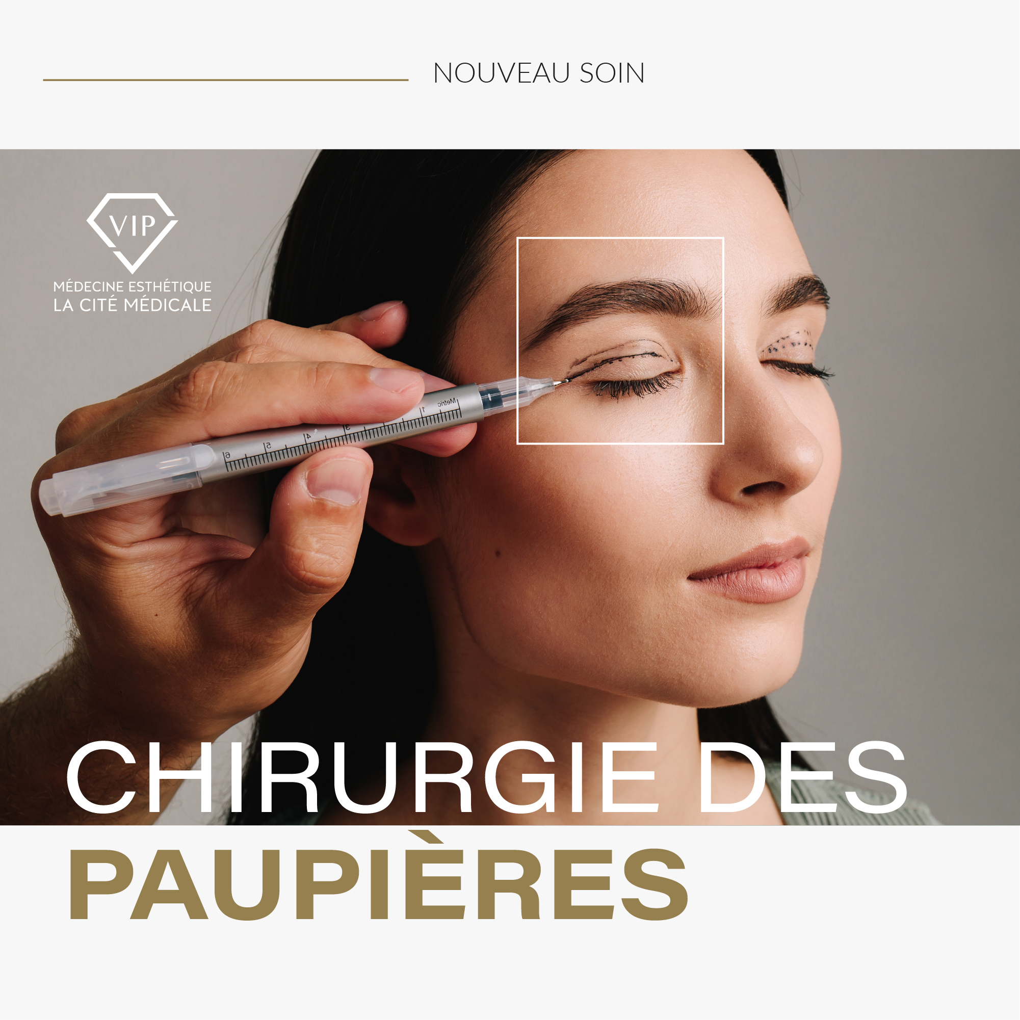 Médecine Esthétique VIP - La Cité Médicale Facebook ad: Redonnez de l’éclat à votre regard