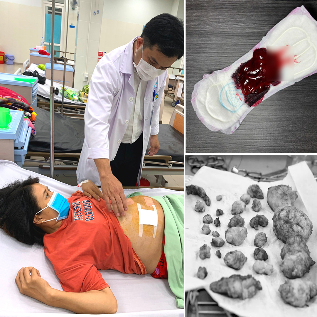 Teacher maria Facebook ad: Methods for shrinking tumors at home