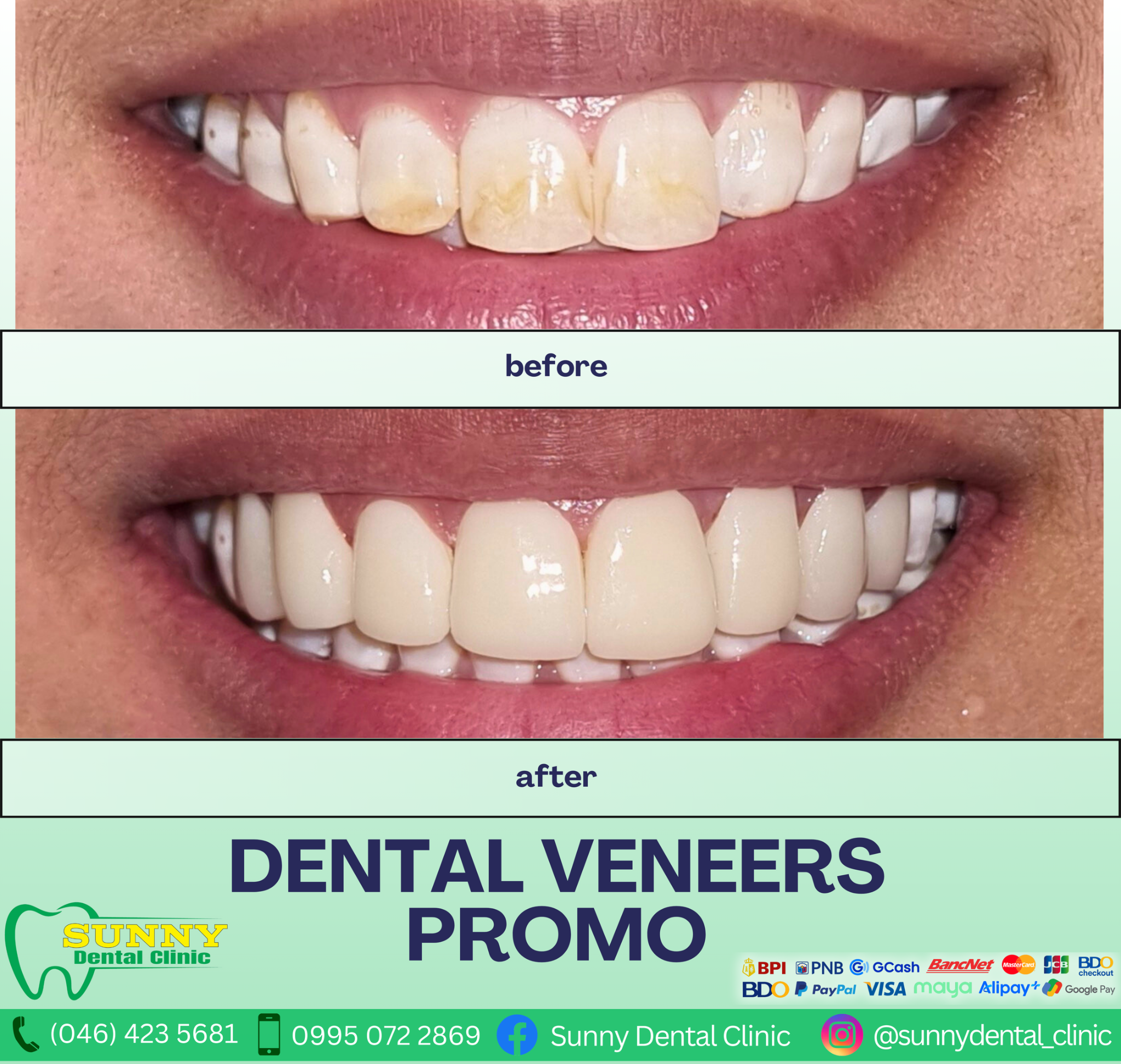 Sunny Dental Clinic Facebook ad