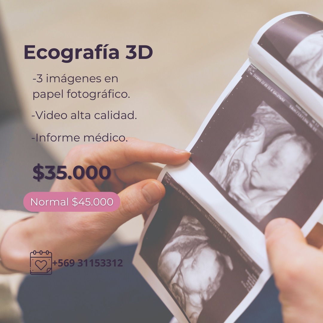 Agenda Ecografía Facebook ad