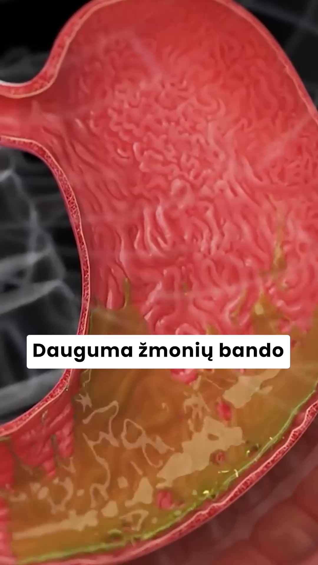 Hora Facebook ad: Skaidulos su prebiotikais, probiotikais ir postbiotikais.