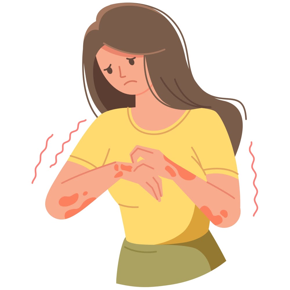 Eczema & Psoriasis Blog Facebook ad
