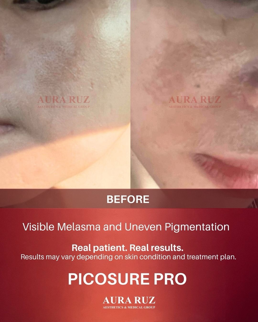 The Aura Ruz Timog Branch Facebook ad: Real patient. Real results.
