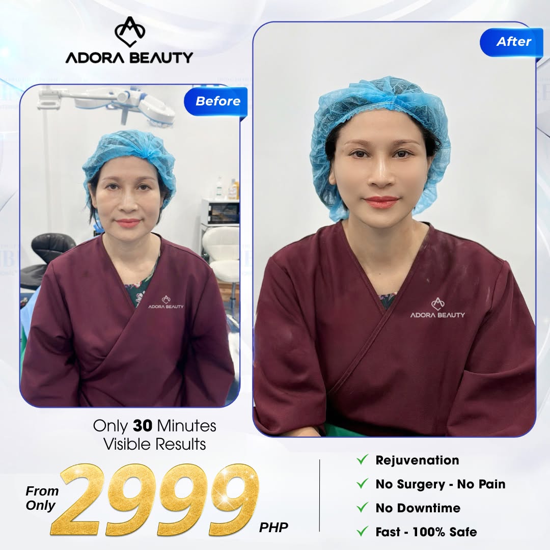 ADORA Beauty Center - Where beauty reigns Facebook ad: Disscount Up To 30% First 50 customers only