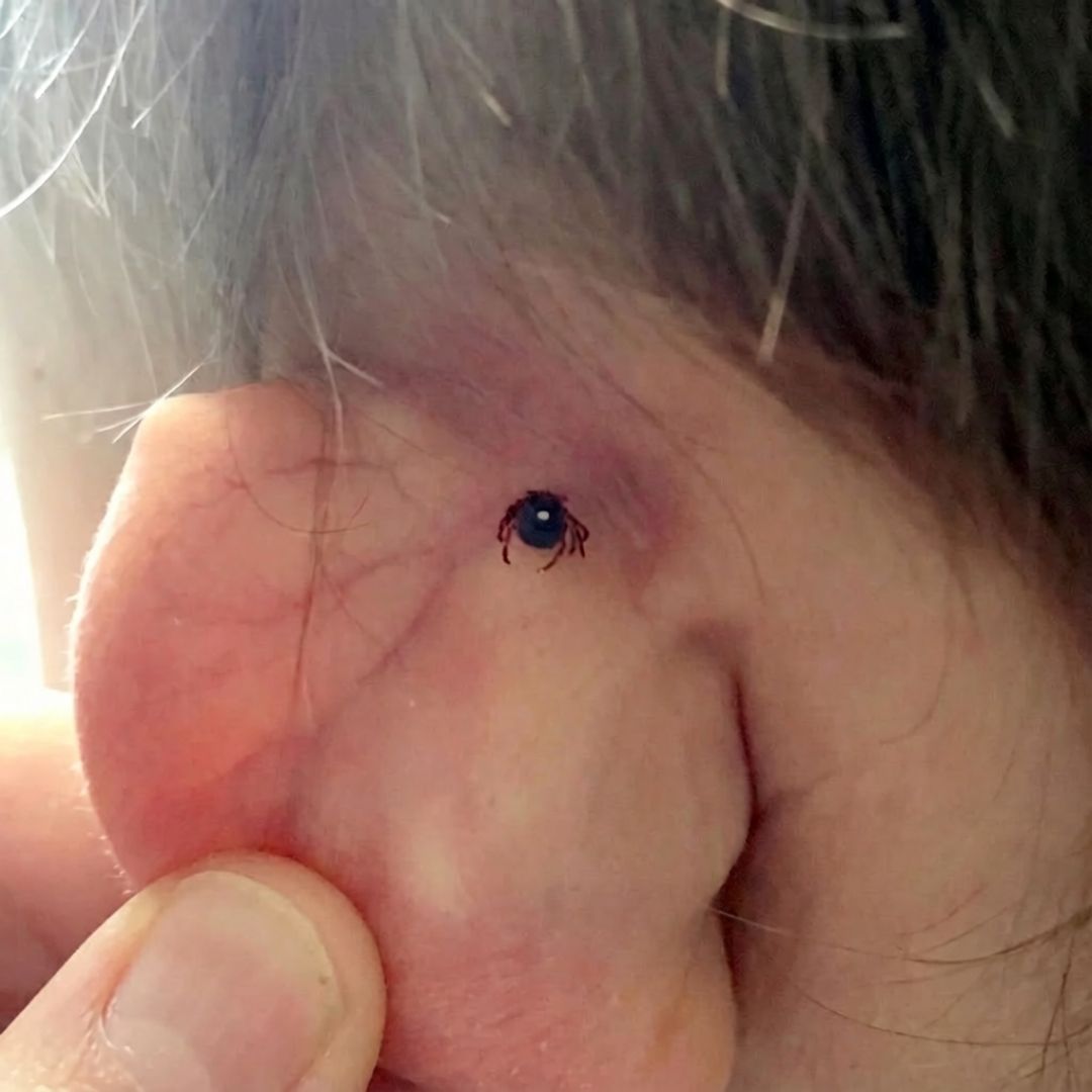 The Natural Healing Journal Facebook ad: A tick gave my 9 year old a lifelong allergy in 90…