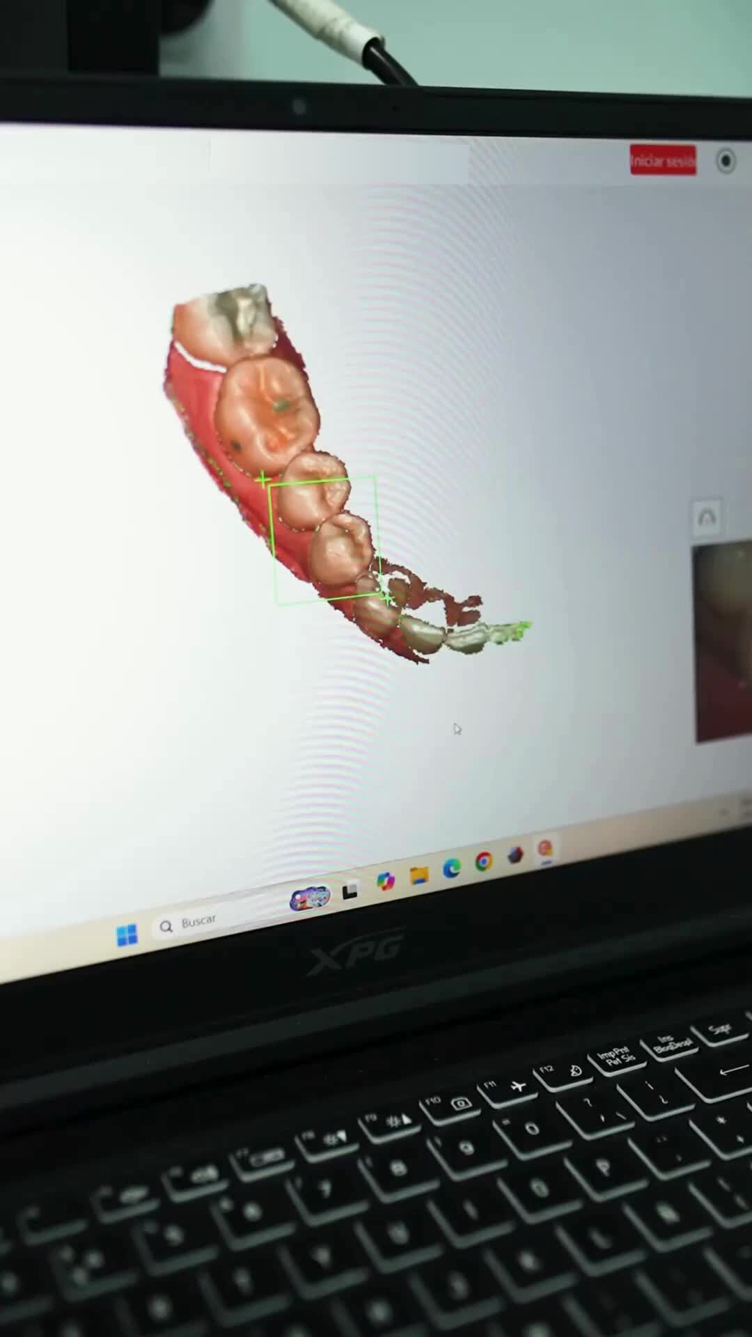 Ryes Ortodoncia Facebook ad: ¡Alineá tus dientes sin usar brackets!