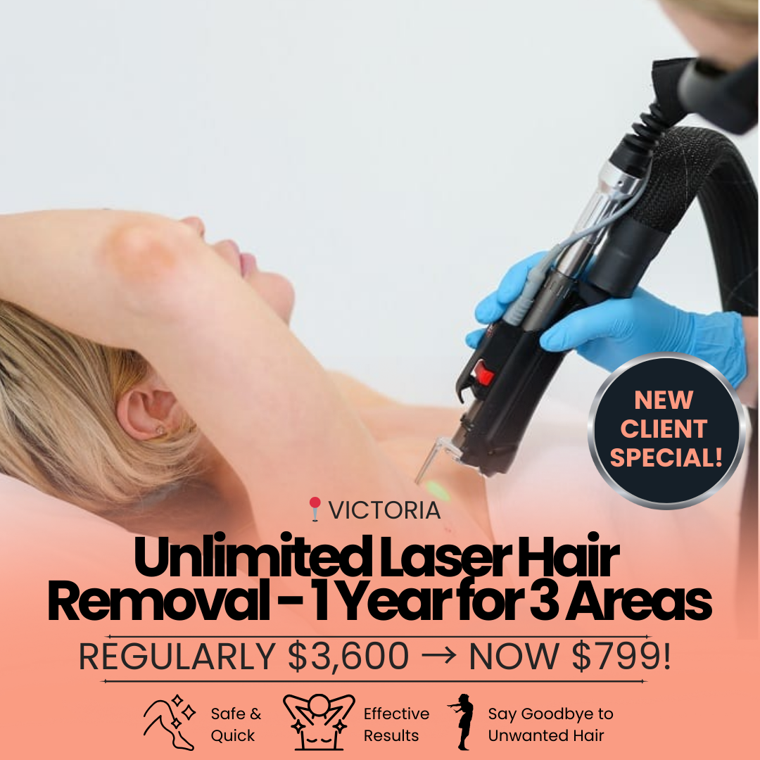 Victoria Laser and Beauty Facebook ad: Unlimited Laser Hair Removal 1 Year for 3 Areas NOW $799!