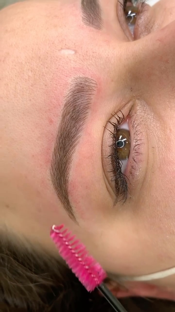Microblanding Aygun Kamran Facebook ad: Prosedur-Nanobrows
