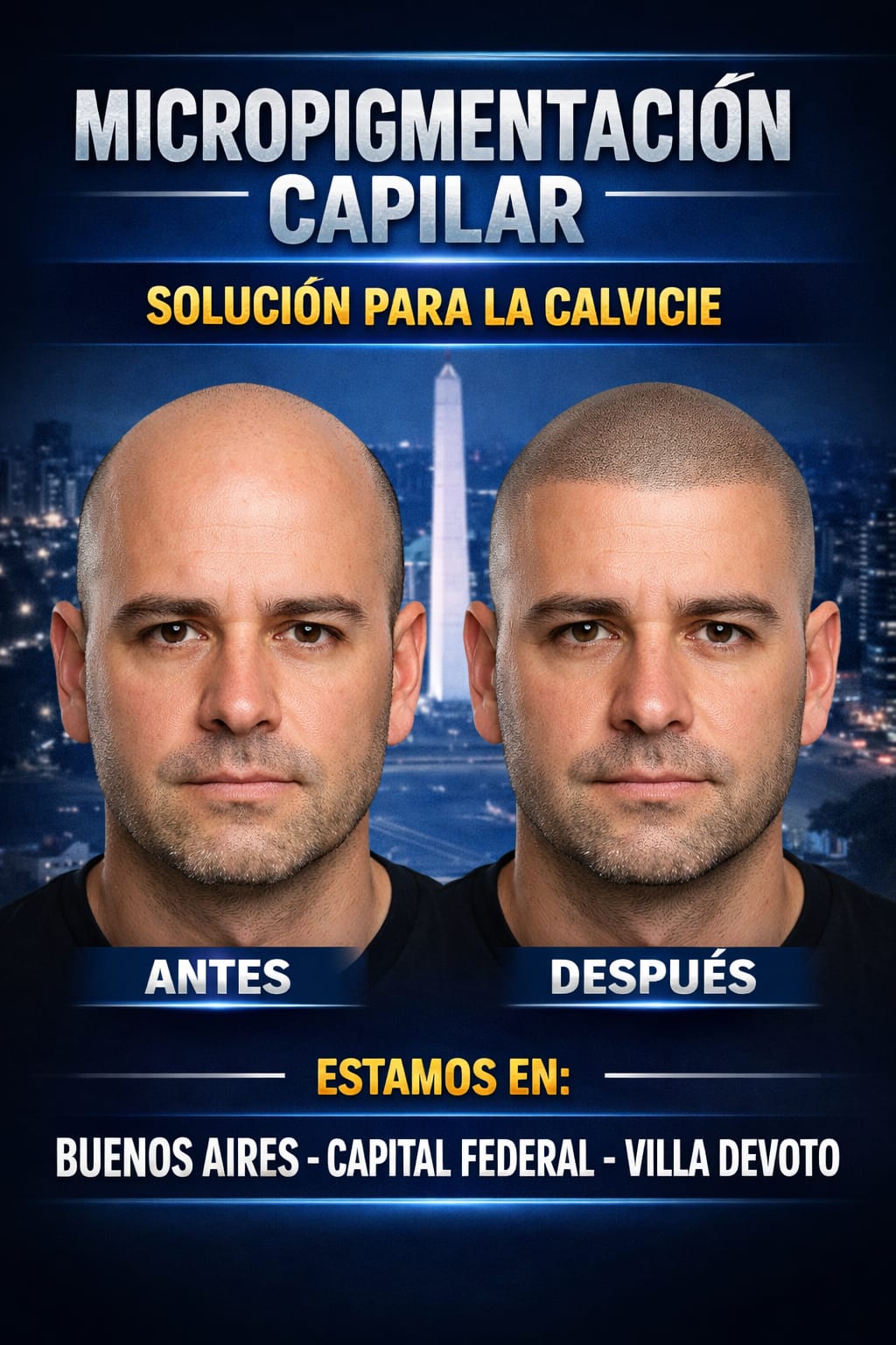 Microcapilardevoto Facebook ad: micropigmentacion capilar