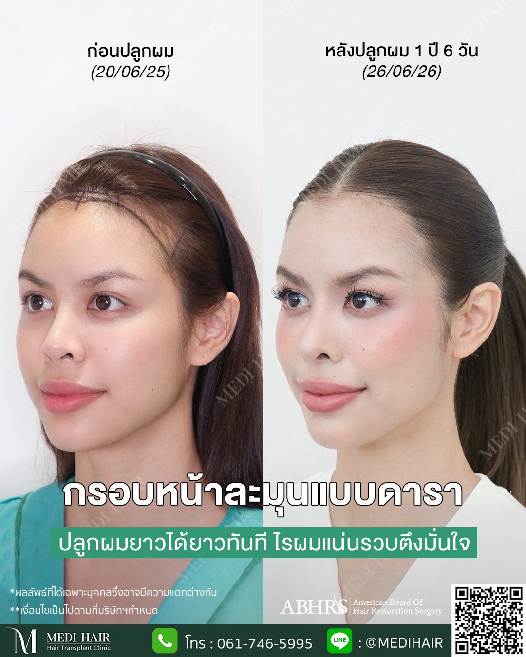 MEDI HAIR Facebook ad