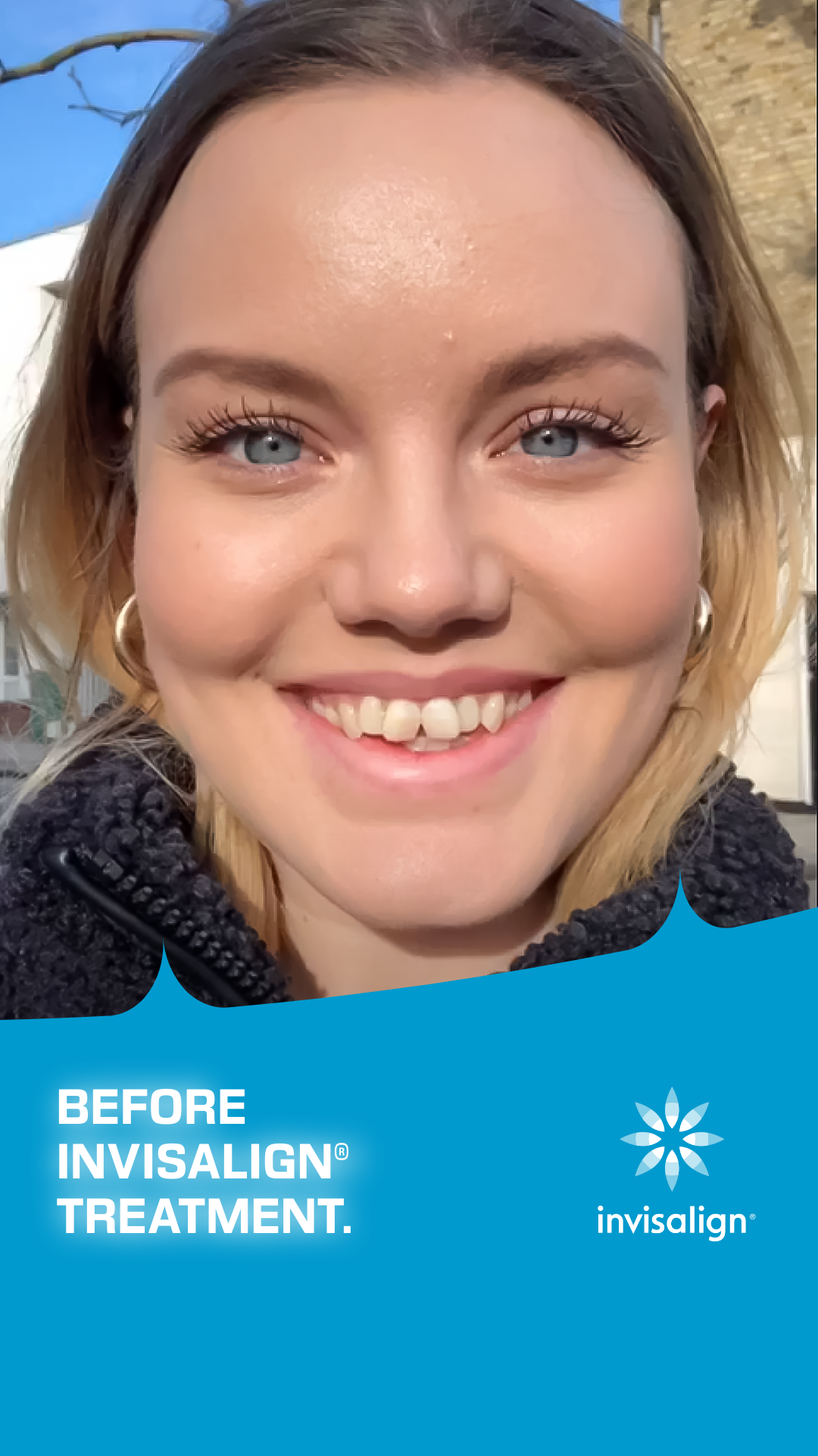 Invisalign UK & Ireland Facebook ad
