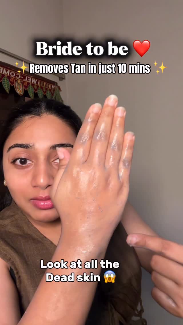 Sanfe India Facebook ad: Comment for link Bride/Groom to be (Dead skin…