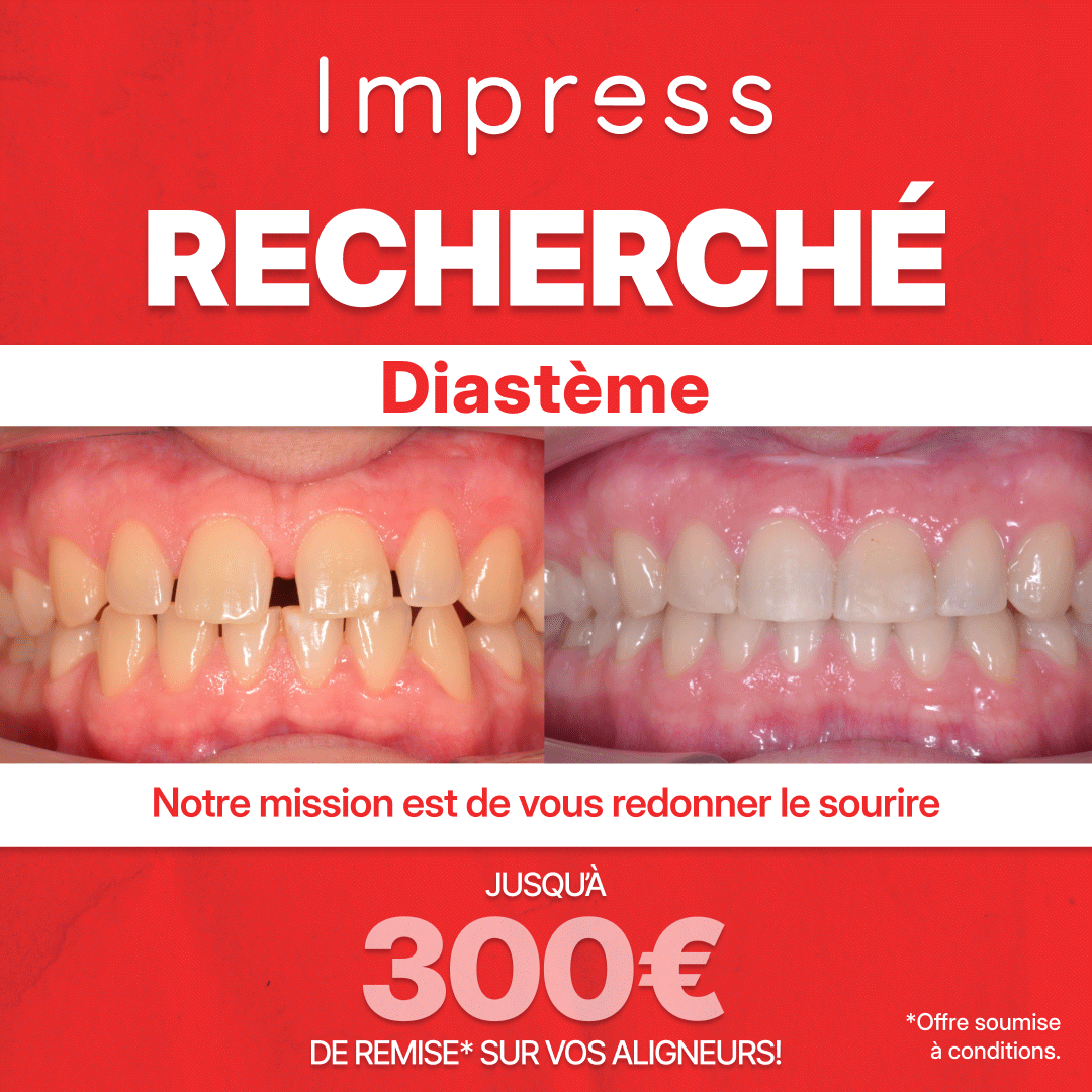 Impress_fr Facebook ad from Jun 2, 2026