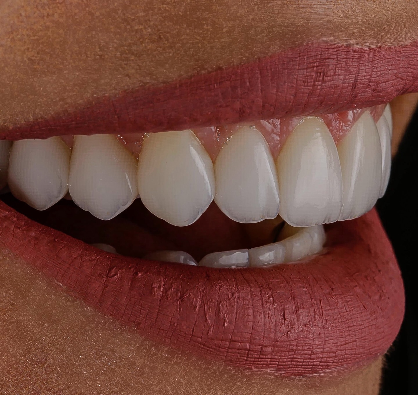 Rildo Lasmar Odontologia e Estética Facebook ad