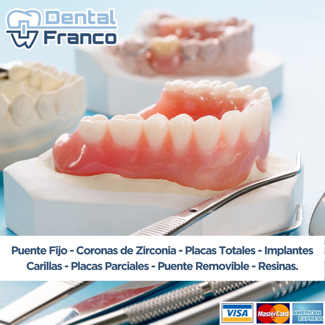 Dental Franco Facebook ad: ยก๐๐๐๐๐๐๐๐ ๐๐ ๐๐๐ ๐๐ร๐๐๐๐๐โฆ