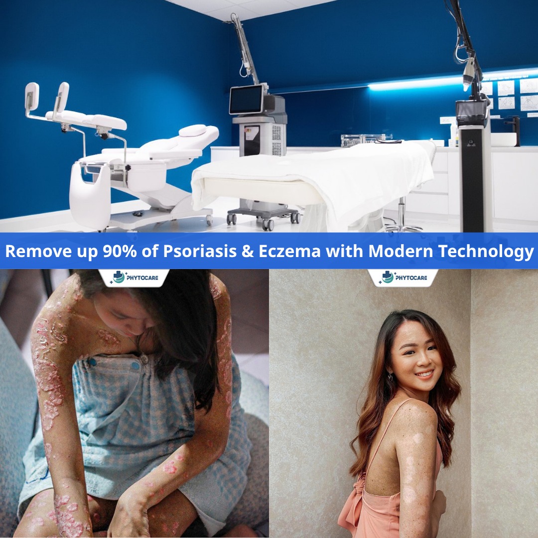 Phytocare Dermatology Clinic Davao Facebook ad: 𝗜𝗡 𝗗𝗔𝗩𝗔𝗢 𝗖𝗜𝗧𝗬, 𝗮 𝘁𝗿𝘂𝗲 𝘀𝗮𝘃𝗶𝗼𝗿 𝗳𝗼𝗿…