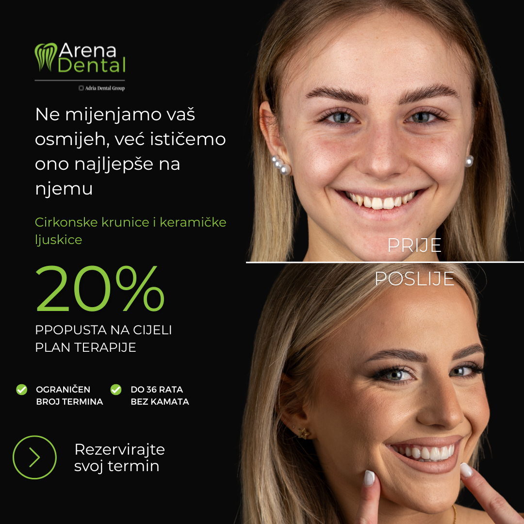 Arena Dental Facebook ad
