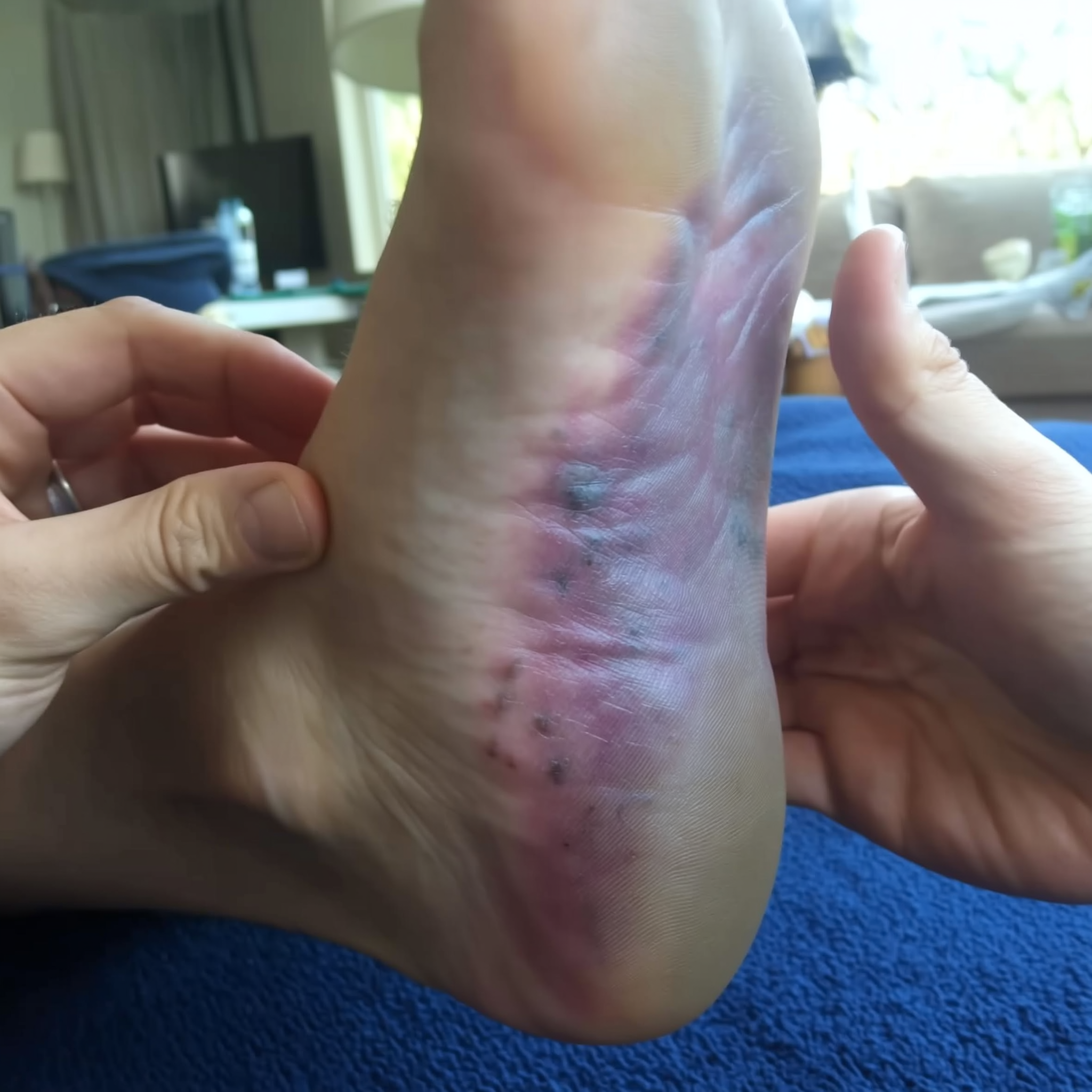 Foot Health Insights Facebook ad