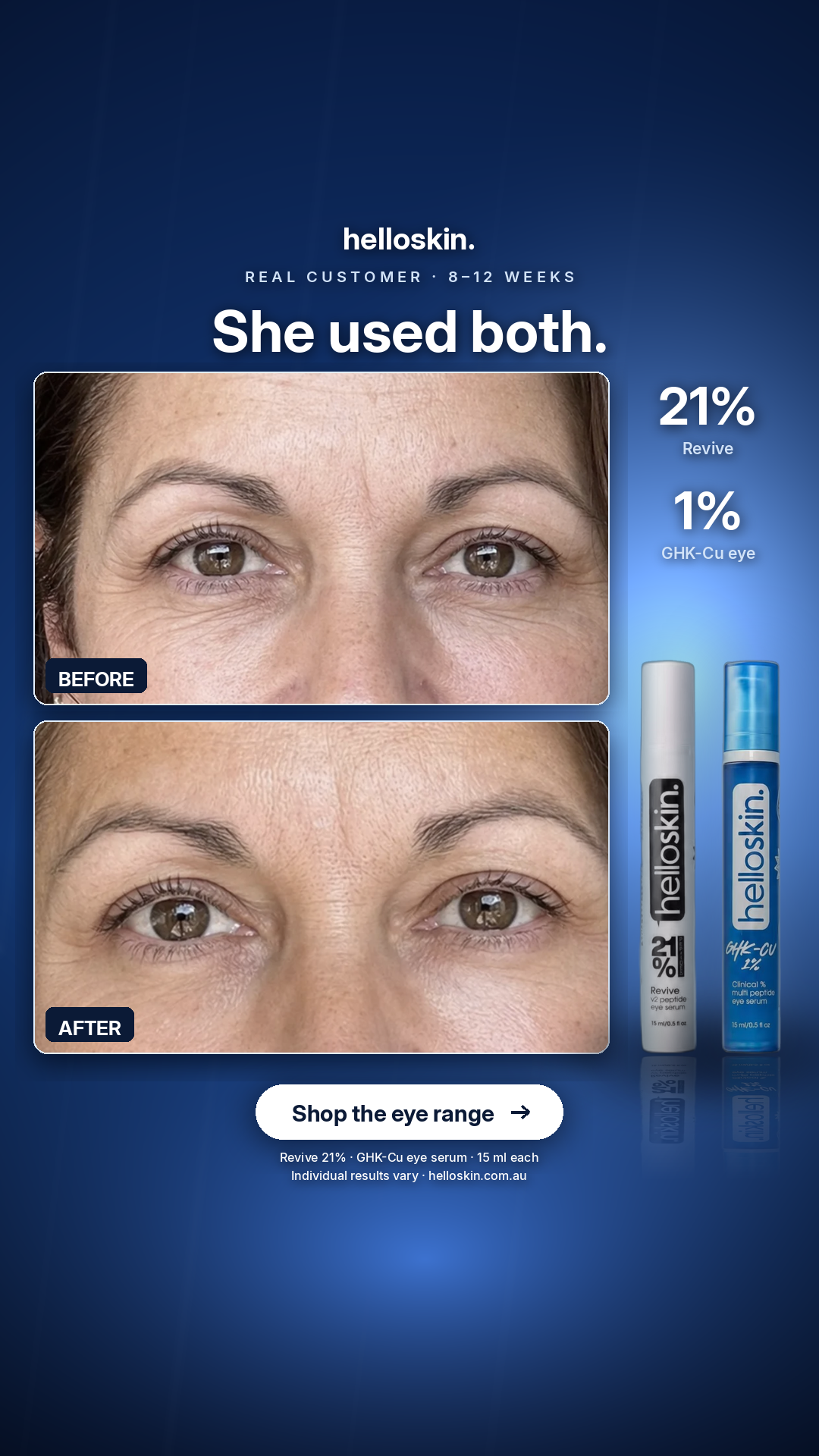Helloskin Facebook ad: She used both.